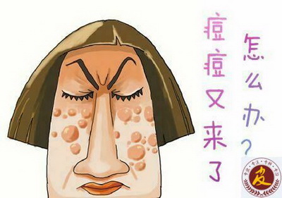 ݳȥഺķ