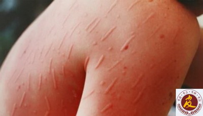 ݡ֢״Щ  ݡκ˻ᴫȾ