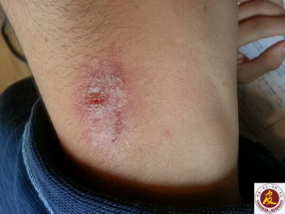 ݡԴ ݡ᲻