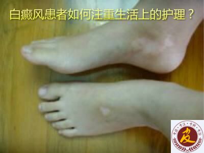 综κû