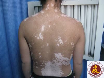 Ԥ糣ķЩ ַԤ